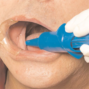 syringe gel impression dental syringe gel impression dental